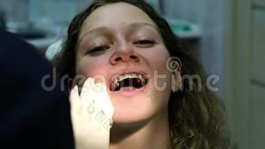 金属牙套特写，看牙医.. 正畸医生完成安装